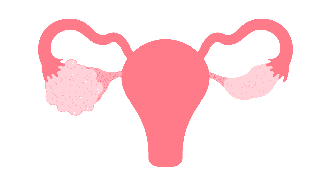 A uterus